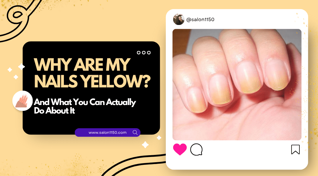 A hand with yellow-stained nails next to a graphic that says “Why Are My Nails Yellow? And What You Can Actually Do About It.”