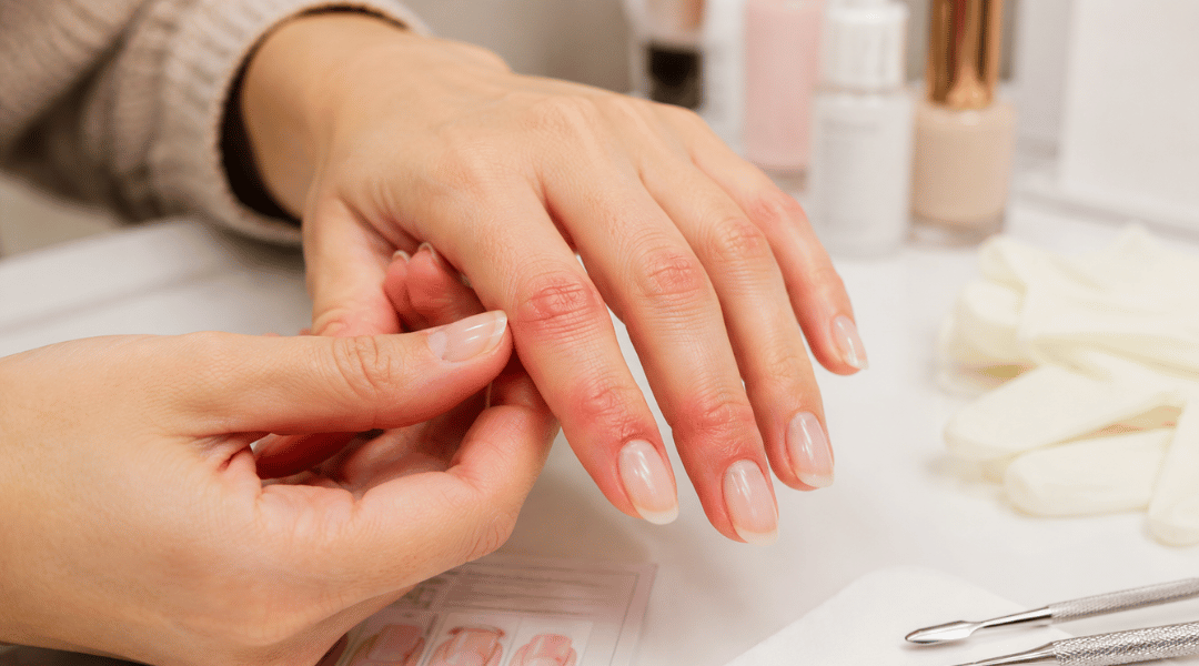 Close-up of fingers showing mild redness and irritation around the nail area, illustrating early signs of an acrylate allergy from nail enhancement products.